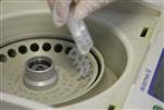 Hausse de 16% du résultat opérationnel courant de biomérieux