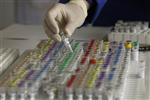Amgen rate le consensus de peu au 4e trimestre