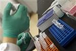 Des postes de chercheurs menacés en france chez sanofi