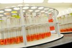 Transgene obtient des financements pour de nouvelles études