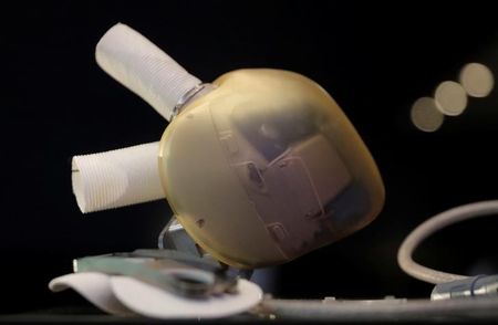 Carmat: Implantation d'un coeur artificiel en République tchèque