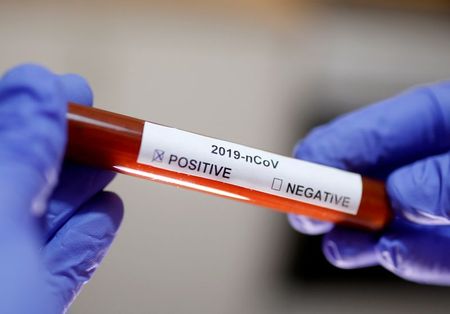 BioMérieux développe trois nouveaux tests de diagnostic du coronavirus