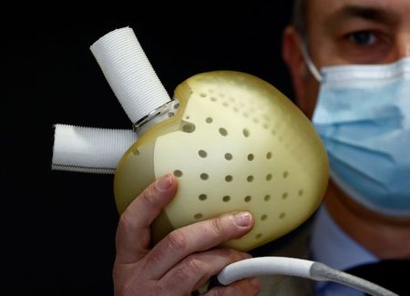 Carmat annonce la première implantation de son coeur artificiel chez une femme