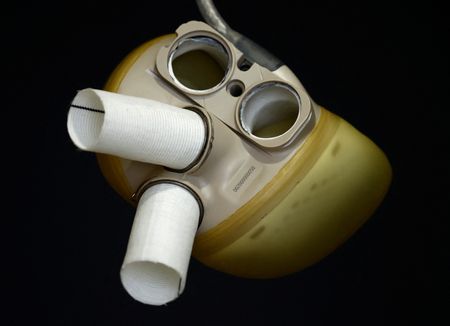 Carmat dit avoir terminé l'enquête sur les problèmes de son coeur artificiel