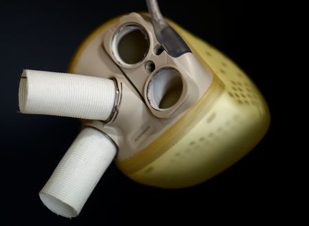 Carmat annonce avoir réalisé 20 implantations au 2e trimestre, vise un CA annuel de 14 millions d'eu
