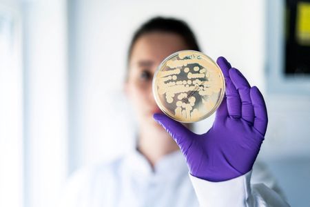 Marché : Bavarian Nordic annonce 321 millions d'euros de commandes pour ses vaccins contre le mpox e